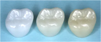 Z冠スタンダードサンプル