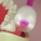 歯ぐきケア