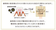 歯周病の炎症