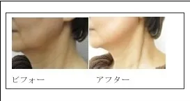 フェイスライン