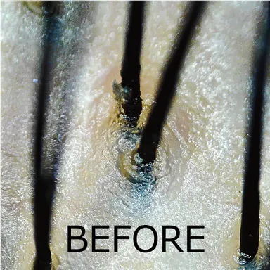 毛穴シャンプー使用前