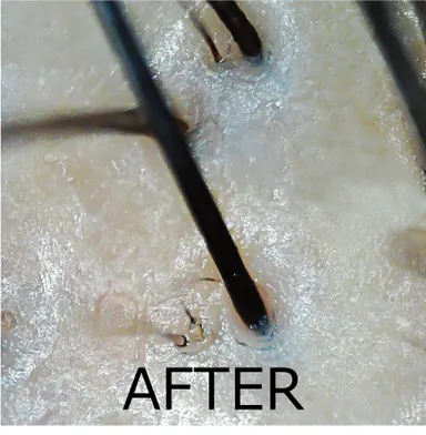 毛穴シャンプー使用後