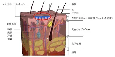 皮膚断面図