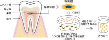 ヒト乳歯幹細胞培養上清液