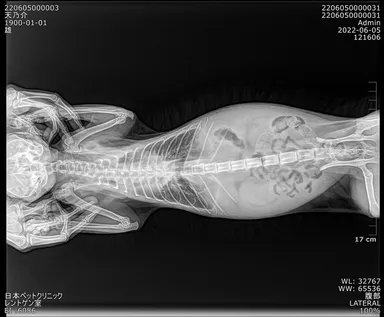 レントゲン写真