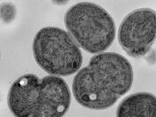 シアノバクテリアの電子顕微鏡写真