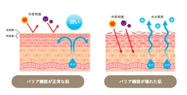 アトピー性皮膚炎の方の共通の肌状態