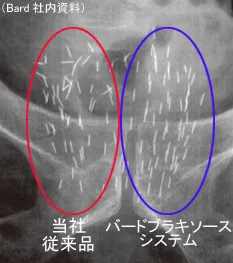 シード線源が埋め込まれたX線画像