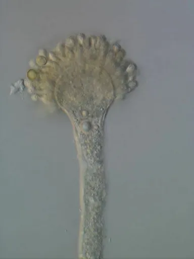 アスペルギルス・フラブス