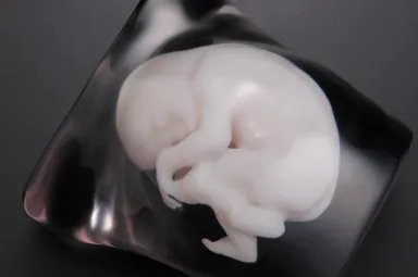 昨年7月に開始された「天使のかたち～LOVE～」