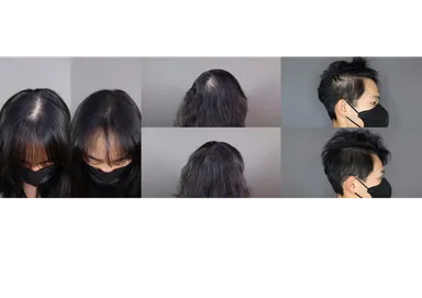 施術画像(分け目が気になる方／つむじ付近が気になる方／サイドが気になる方)
