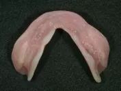 2.抗菌前の汚れた総入れ歯