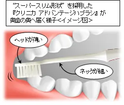 クリニカ アドバンテージハブラシが「奥歯の奥」まで届く様子