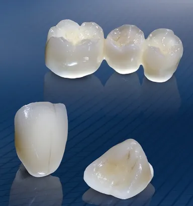 セルコンZ冠のイメージ画像