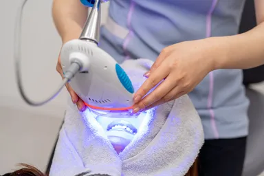 院内で行うホームホワイトニング