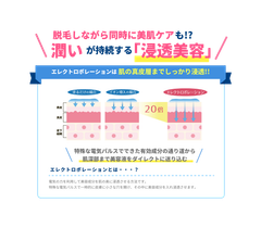エレクトロポレーション