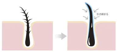まつ毛のキューティクルを引き締める