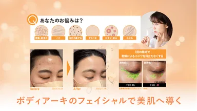 定額制セルフエステBODY ARCHI(ボディアーキ) SBC湘南美容クリニック 定額制セルフエステBODY ARCHI(ボディアーキ) SBC湘南美容クリニック