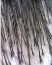 ブラシ使用後の根元(毛穴から生えた髪が整列している)