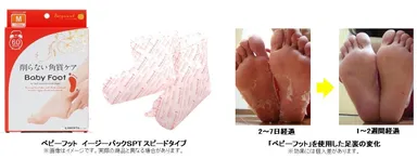 ベビーフット製品概要