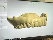 入れ歯の形状がデータ化
