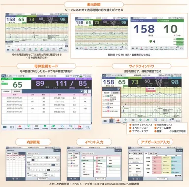 画面イメージと機能の種類