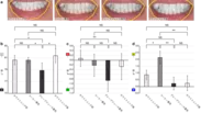 図1. アプリで撮影したホワイトニング前後の歯の画像(a)と色の変化(b-d)