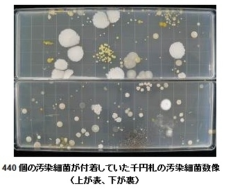 440個の汚染細菌が付着していた千円札の汚染細菌数像