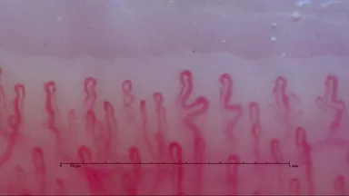 末梢血流スコープ検査画像