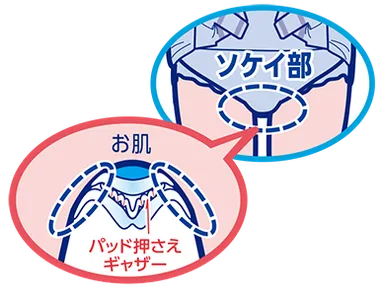 パッド押さえギャザー