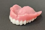 予備入れ歯。3Dプリンターで全く同じ入れ歯が約1週間で完成