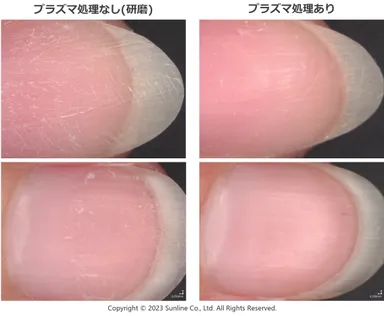 図3．ネイルオフ時の爪甲外観の比較