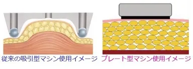 従来マシンとの比較