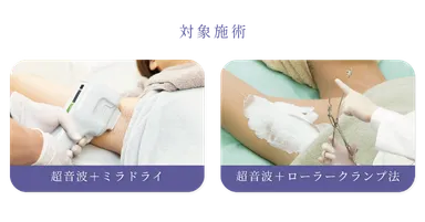 キャンペーン対象施術