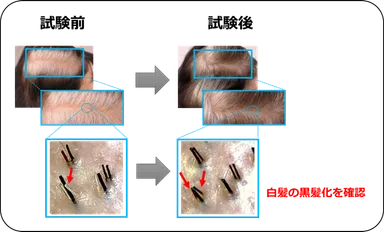 図3：明確な白髪の改善を複数確認