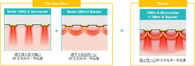 ダイヤモンドチップの仕組み