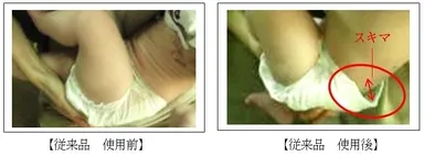 (3) 紙おむつがズレたことで、スキマが発生