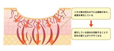 キュアジェットとサブシジョンの仕組み