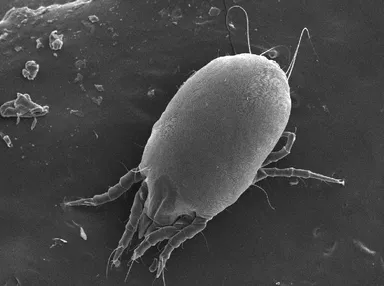 ダニアレルゲン