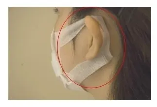 伸縮素材の耳かけ