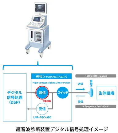 超音波診断装置デジタル信号処理イメージ