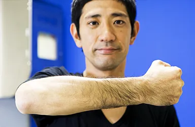 自身の剛毛を見せる柴田さん