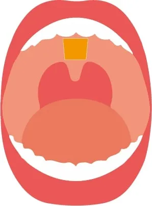 貼り付けイメージ
