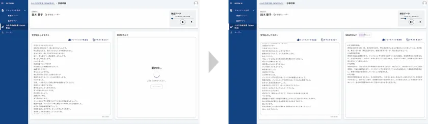 カルテの作成支援β版