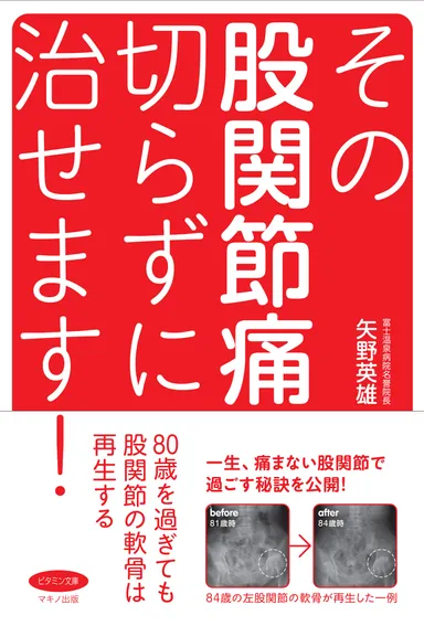 『その股関節痛、切らずに治せます！』表紙
