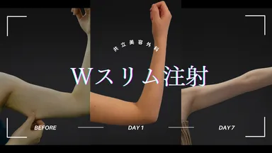 Wスリム注射症例写真