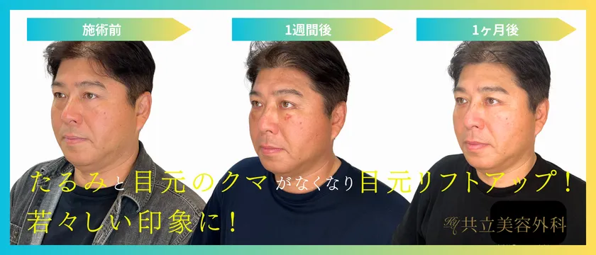 真中満氏クマ取り治療