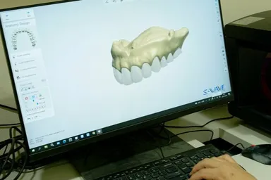 スキャンした入れ歯データを保管中