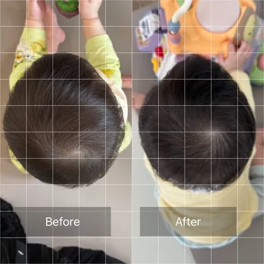 2歳の女の子です。