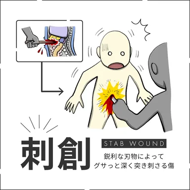 刺創